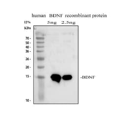 Invitrogen BDNF Polyclonal Antibody 100 &mu;g | Buy Online | Invitrogen&trade; | Fisher Scientific