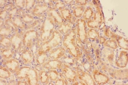 CXCR3 Polyclonal Antibody:Antibodies, Polyclonal