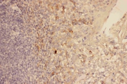 CXCR3 Polyclonal Antibody:Antibodies, Polyclonal