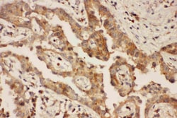 CXCR3 Polyclonal Antibody:Antibodies, Polyclonal