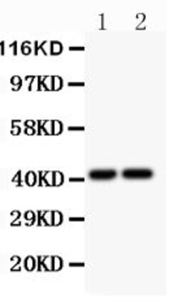 CXCR3 Polyclonal Antibody:Antibodies, Polyclonal