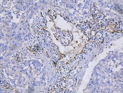 Invitrogen CD31 Polyclonal Antibody 100 &mu;g; Unconjugated:Antibodies,