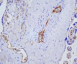 Invitrogen CD31 Polyclonal Antibody 100 &mu;g; Unconjugated:Antibodies,