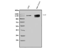 Invitrogen CD31 Polyclonal Antibody 100 &mu;g; Unconjugated:Antibodies,