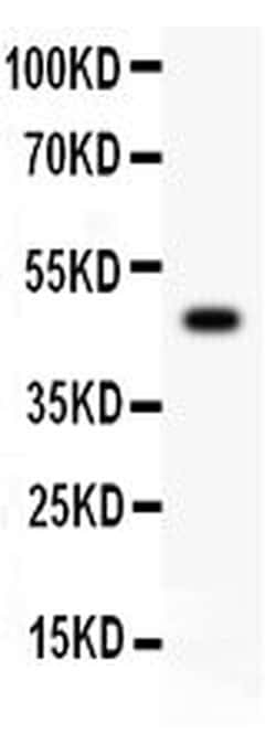 Invitrogen CD45 Polyclonal Antibody 100 &mu;g; Unconjugated:Antibodies,