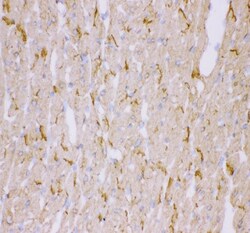 Invitrogen Desmin Polyclonal Antibody 100 &mu;g | Buy Online | Invitrogen&trade; | Fisher Scientific