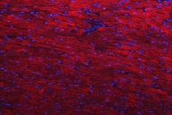Invitrogen Desmin Polyclonal Antibody 100 &mu;g | Buy Online | Invitrogen&trade; | Fisher Scientific