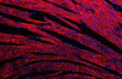 Invitrogen Desmin Polyclonal Antibody 100 &mu;g | Buy Online | Invitrogen&trade; | Fisher Scientific