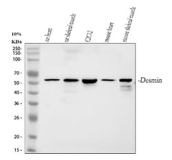 Invitrogen Desmin Polyclonal Antibody 100 &mu;g | Buy Online | Invitrogen&trade; | Fisher Scientific