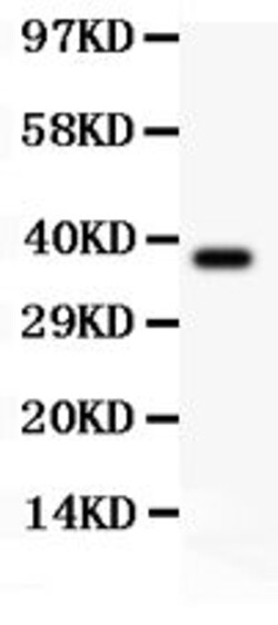 Invitrogen NLRP3 Polyclonal Antibody 100 &mu;g; Unconjugated:Antibodies,