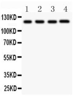 Invitrogen NLRP3 Polyclonal Antibody 100 &mu;g; Unconjugated:Antibodies,