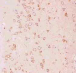 Invitrogen TSC2 Polyclonal Antibody 100 &mu;g; Unconjugated:Anticuerpos