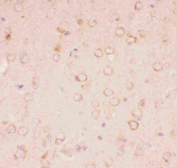 Invitrogen TSC2 Polyclonal Antibody 100 &mu;g; Unconjugated:Anticuerpos