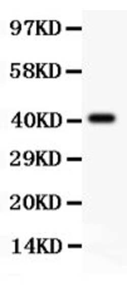 Invitrogen TSC2 Polyclonal Antibody 100 &mu;g; Unconjugated:Anticuerpos