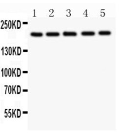 Invitrogen TSC2 Polyclonal Antibody 100 &mu;g; Unconjugated:Anticuerpos