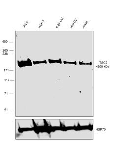 Invitrogen TSC2 Polyclonal Antibody 100 &mu;g; Unconjugated:Anticuerpos