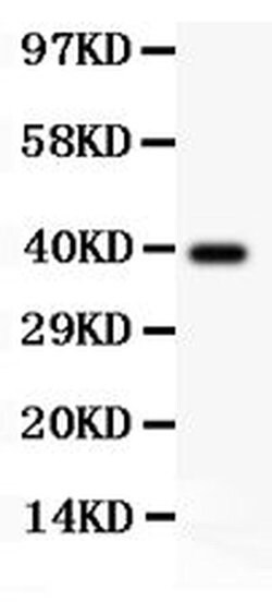 Invitrogen SIRT3 Polyclonal Antibody 100 &mu;g; Unconjugated:Antibodies,