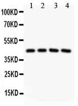 Invitrogen SIRT3 Polyclonal Antibody 100 &mu;g; Unconjugated:Antibodies,