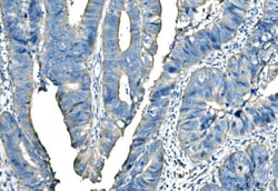 Invitrogen B-Raf Polyclonal Antibody 100 &mu;g; Unconjugated:Antibodies,