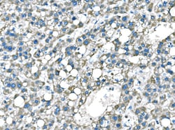 Invitrogen B-Raf Polyclonal Antibody 100 &mu;g; Unconjugated:Antibodies,