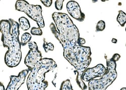 Invitrogen B-Raf Polyclonal Antibody 100 &mu;g; Unconjugated:Antibodies,