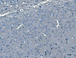 Invitrogen B-Raf Polyclonal Antibody 100 &mu;g; Unconjugated:Antibodies,