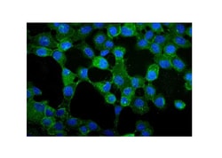 Invitrogen gamma Catenin Polyclonal Antibody 100 &mu;g; Unconjugated:Antibodies,