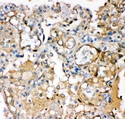Invitrogen KCNMA1 Polyclonal Antibody 100 &mu;g; Unconjugated:Antibodies,