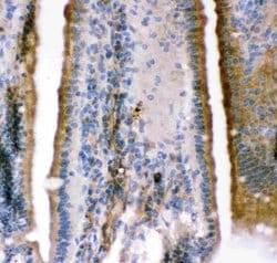 Invitrogen KCNMA1 Polyclonal Antibody 100 &mu;g; Unconjugated:Antibodies,