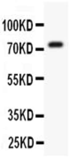 Invitrogen KV4.3 (KCND3) Polyclonal Antibody 100 &mu;g; Unconjugated:Antibodies,