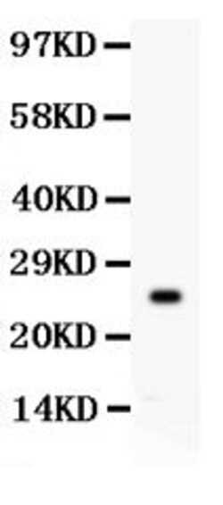 Invitrogen Kallikrein 4 Polyclonal Antibody 100 &mu;g; Unconjugated:Antibodies,