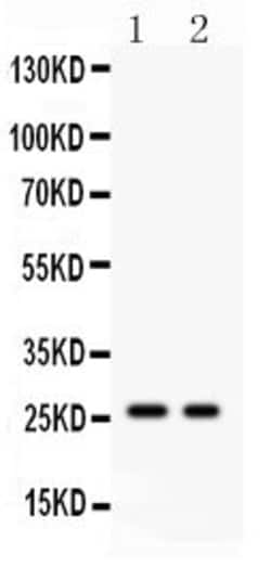 Invitrogen Kallikrein 4 Polyclonal Antibody 100 &mu;g; Unconjugated:Antibodies,