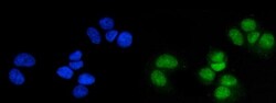 Invitrogen MSK1 Polyclonal Antibody 100 &mu;g; Unconjugated:Antibodies,