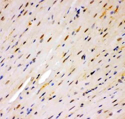 Invitrogen MSK1 Polyclonal Antibody 100 &mu;g; Unconjugated:Antibodies,