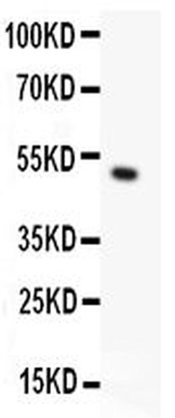 TRPC5 Polyclonal Antibody:Antibodies, Polyclonal