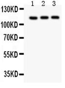 TRPC5 Polyclonal Antibody:Antibodies, Polyclonal