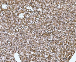 Invitrogen MIF Polyclonal Antibody 100 &mu;g; Unconjugated:Antibodies,