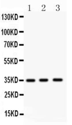 Invitrogen Nkx2.5 Polyclonal Antibody 100 &mu;g; Unconjugated:Antibodies,