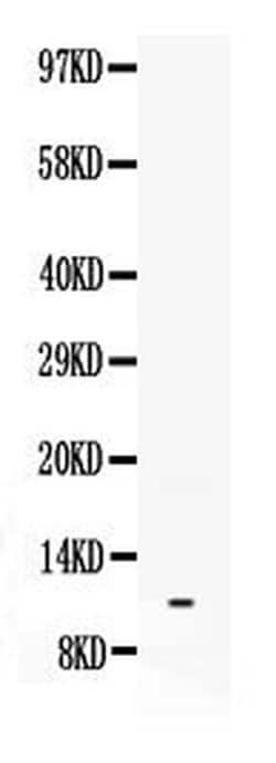 Invitrogen NPY Polyclonal Antibody 100 &mu;g; Unconjugated:Antibodies,