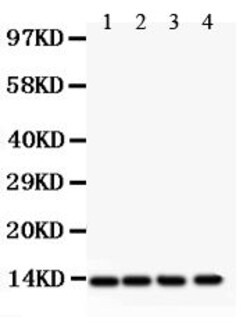 Invitrogen PDGF-B Polyclonal Antibody 100 &mu;g; Unconjugated:Antibodies,