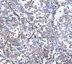 Invitrogen SERPINH1 Polyclonal Antibody 100 &mu;g; Unconjugated:Antibodies,