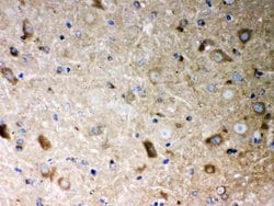 Invitrogen PP2A alpha Polyclonal Antibody 100 &mu;g; Unconjugated:Antibodies,