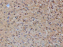 Invitrogen PP2A alpha Polyclonal Antibody 100 &mu;g; Unconjugated:Antibodies,