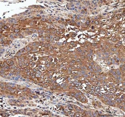 Invitrogen PP2A alpha Polyclonal Antibody 100 &mu;g; Unconjugated:Antibodies,