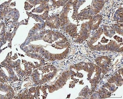 Invitrogen PP2A alpha Polyclonal Antibody 100 &mu;g; Unconjugated:Antibodies,