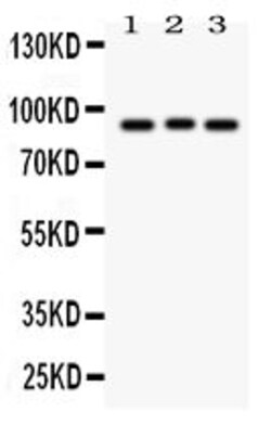 Invitrogen SEMA3A Polyclonal Antibody 100 &mu;g; Unconjugated:Antibodies,