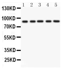 Invitrogen CD36 Polyclonal Antibody 100 &mu;g | Buy Online | Invitrogen&trade; | Fisher Scientific