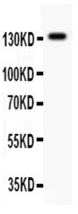 Invitrogen NMDAR2C Polyclonal Antibody 100 &mu;g; Unconjugated:Antibodies,