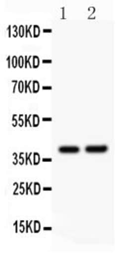 Invitrogen SOX1 Polyclonal Antibody 100 &mu;g; Unconjugated:Antibodies,