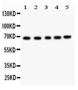 Invitrogen Acetylcholinesterase Polyclonal Antibody 100 &mu;g; Unconjugated:Antibodies,